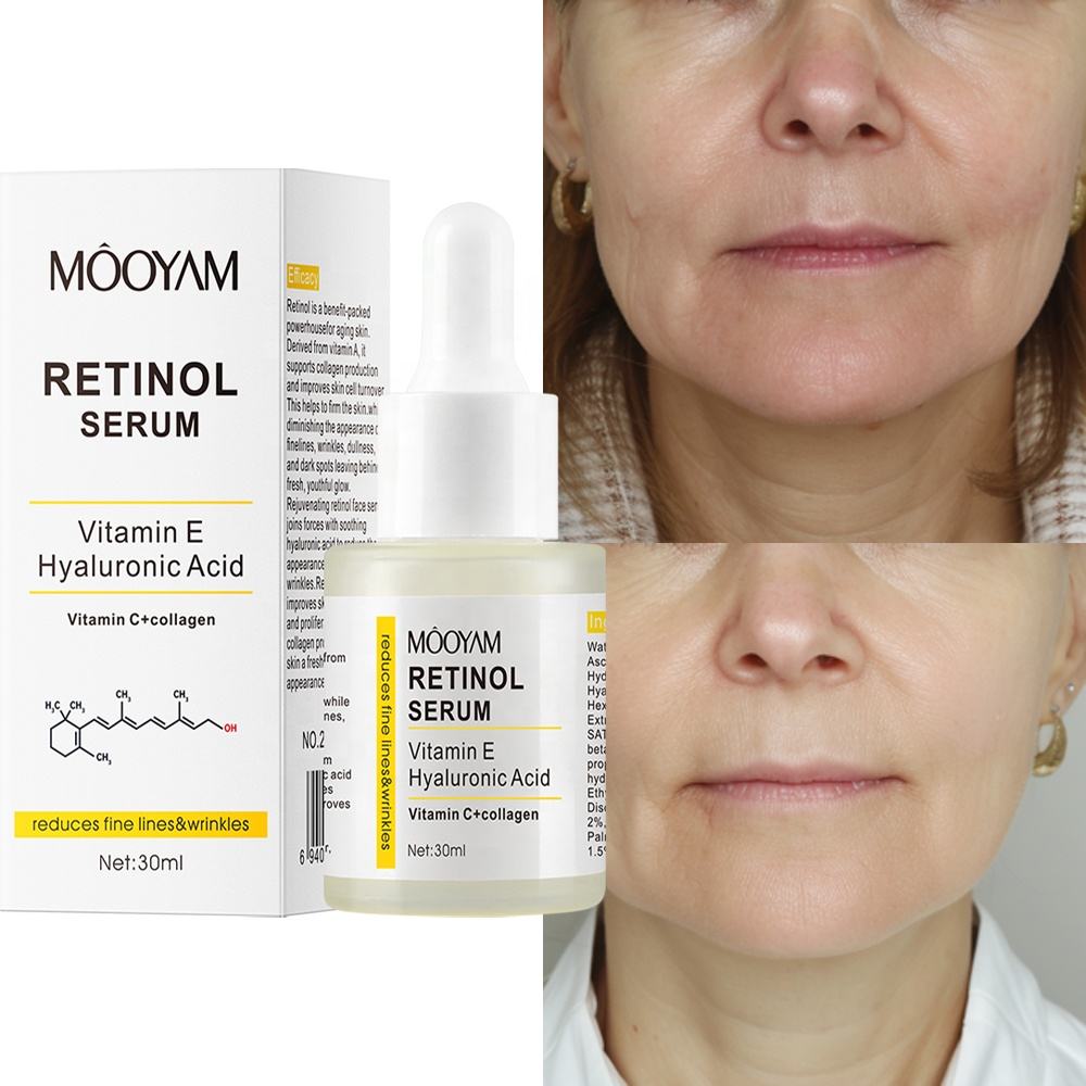 Instant Retinol Anti‑Wrinkle Serum – Lifting, Firming & Brightening Night Serum – Face Care – 30ml